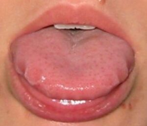 Blessures superficielles d’origine traumatique - Les douleurs orales d’autres origines