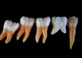 Chez l’enfant - Les différences de dentition entre l’enfant et l’adulte