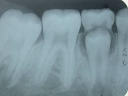 Chez l’enfant - Les différences de dentition entre l’enfant et l’adulte
