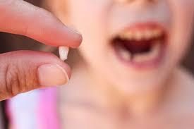 Chez l’enfant - Les différences de dentition entre l’enfant et l’adulte