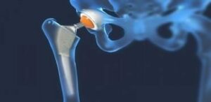 Dans ces conditions, le patient est dit « à risque » . - Les pathologies médicales et les influences de la cavité buccal