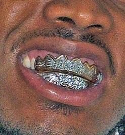 Dents limées «Ohaguro » noircissement des dents couverture dorée (Europe de l’est / Moyen-Orient) - Un peu d’histoire