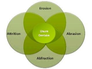 Il existe différente forme d’usure - Les taches brunes et noires