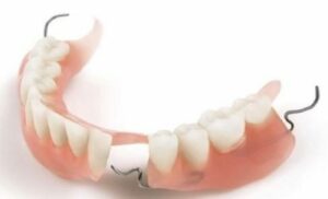 Inconvénients - Perte des dents : comment y remédier ?