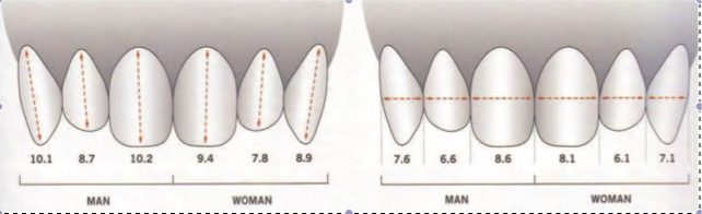 La beauté des dents sur mesure : le secret de l’harmonie - Embellir son sourire ou une dent fragilisée