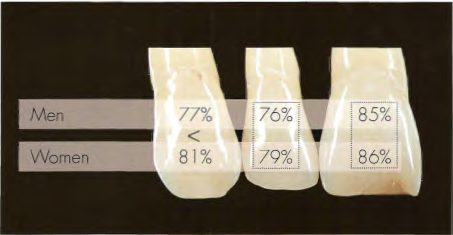 La beauté des dents sur mesure : le secret de l’harmonie - Embellir son sourire ou une dent fragilisée
