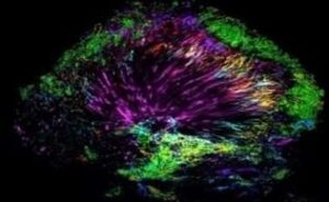 La formation du biofilm dans la plaque dentaire - La formation du biofilm
