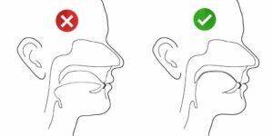 La position de la langue et la déglutition - La croissance harmonieuse du visage