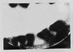 La radiographie dentaire - Un peu d’histoire