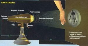 La radiographie dentaire - Un peu d’histoire
