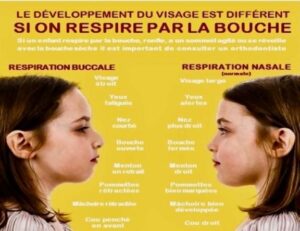 La respiration nasale VS la respiration buccale - La croissance harmonieuse du visage