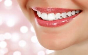 Le blanchiment dentaire général - Embellir son sourire ou une dent fragilisée