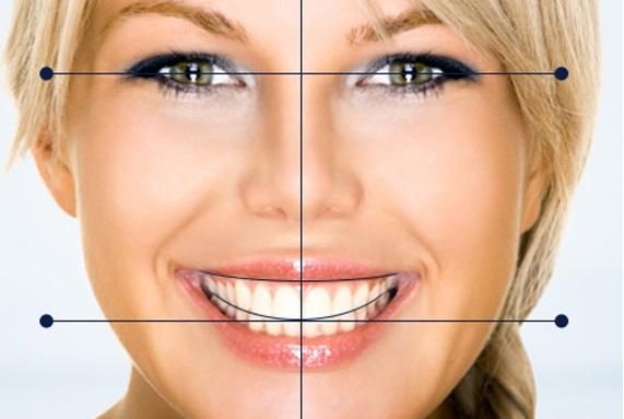 le rapport du collet des incisives avec la lèvre supérieure lors du sourire - Embellir son sourire ou une dent fragilisé