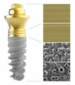 le traitement de surface de l’implant - Perte des dents : comment y remédier ?