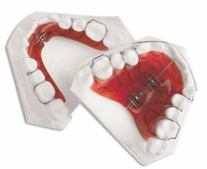 Les « coups de pouce » orthodontiques - La croissance harmonieuse du visage
