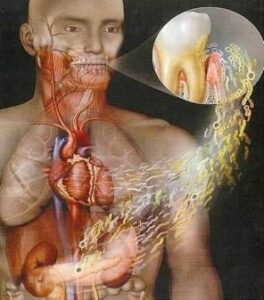 Les maladies cardio-vasculaires - Les pathologies médicales et les influences de la cavité buccale