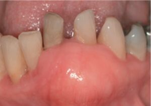 Myxome odontogène - Les douleurs orales d’autres origines