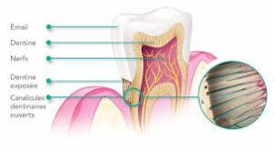 Pourquoi les dents sont sensibles ? - La composition des dentifrices actuels