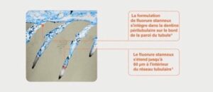 Pourquoi les dents sont sensibles ? - La composition des dentifrices actuels