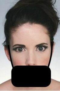 Une dentition harmonieuse: le critère indispensable pour un beau visage - Embellir son sourire ou une dent fragilisée