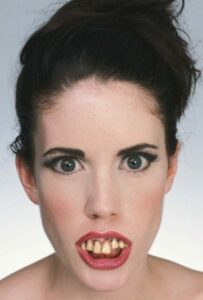 Une dentition harmonieuse: le critère indispensable pour un beau visage - Embellir son sourire ou une dent fragilisée