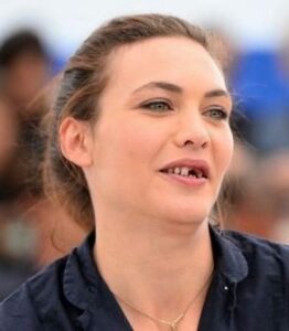 Une dentition harmonieuse: le critère indispensable pour un beau visage - Embellir son sourire ou une dent fragilisée